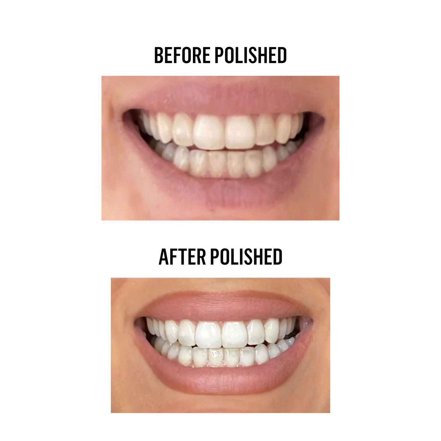 Hyaluronic Teeth Whitening Powder