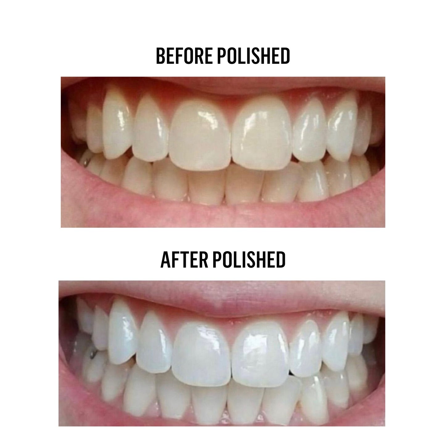 Hyaluronic Teeth Whitening Powder