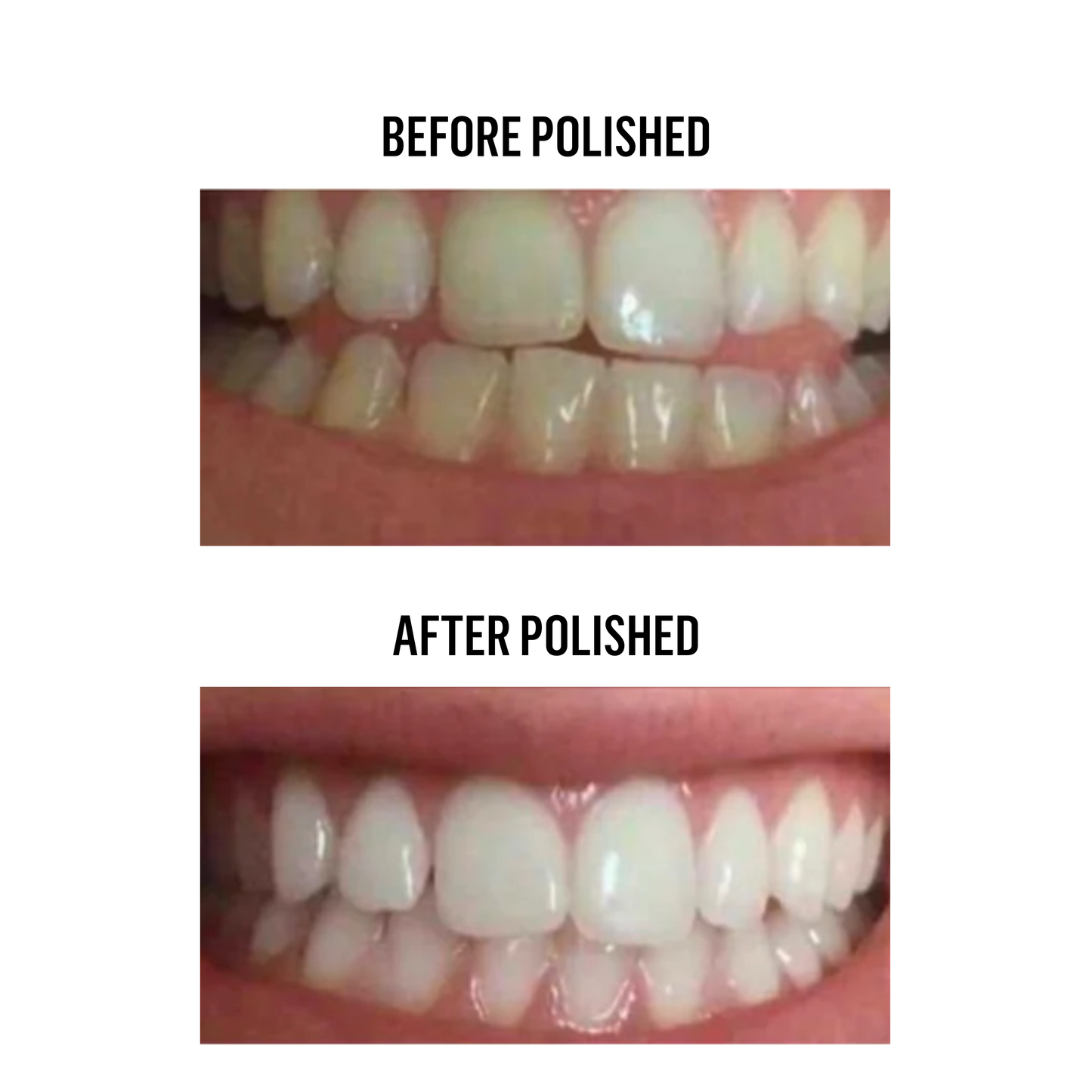 Hyaluronic Teeth Whitening Powder